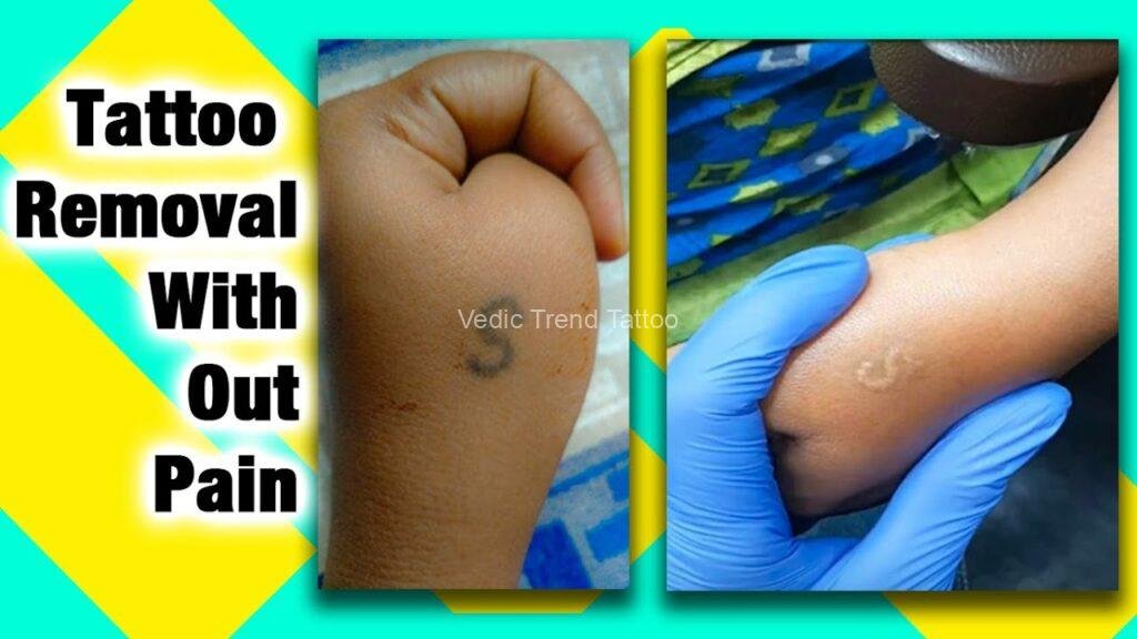 Tattoo studio near me-tattoo shop near me-bangalore-vedic trend tattoo-tattoo-removal-best-tattoo-removal