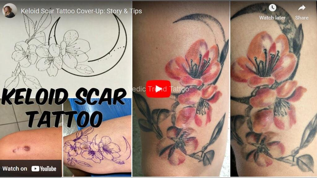 Keloid Scar Tattoo Cover-Up: Story & Tips-Youtube tumbline-Vedic trend tattoo-bangalore-Keloid Scar Tattoo Cover-Up